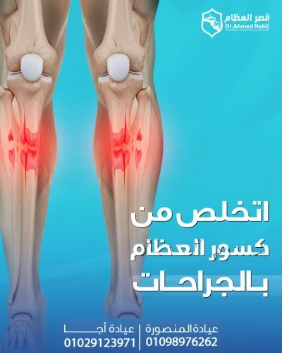 دكتور احمد نبيل استشاري العظام و الكسور و المفاصل