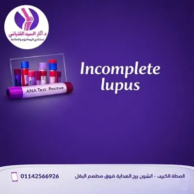 دكتورة آثار السيد الفتياني استشاري روماتيزم و مناعة و التهابات مفاصل و مدرس بكلية الطب جامعة طنطا