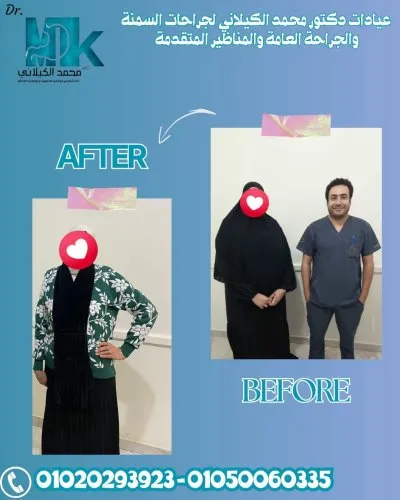 دكتور محمد الكيلاني اخصائي جراحات السمنة والمناظير المتقدمة