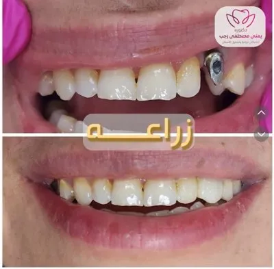دكتورة يمنى مصطفى رجب جراحة وتجميل الأسنان