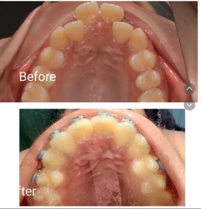 دكتورة يمنى مصطفى رجب جراحة وتجميل الأسنان