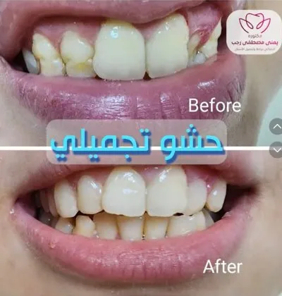 دكتورة يمنى مصطفى رجب جراحة وتجميل الأسنان