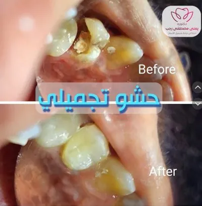 دكتورة يمنى مصطفى رجب جراحة وتجميل الأسنان