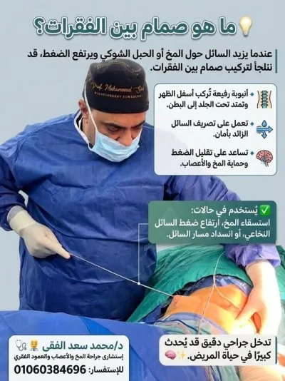 دكتور محمد سعد الفقي استشاري جراحة مخ و اعصاب و عمود فقري
