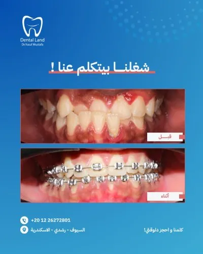 دكتور يوسف مصطفى دنتال لاند لتقويم وتجميل الأسنان