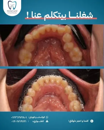دكتور يوسف مصطفى دنتال لاند لتقويم وتجميل الأسنان