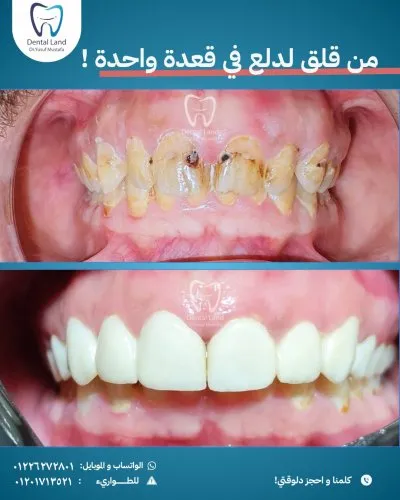 دكتور يوسف مصطفى دنتال لاند لتقويم وتجميل الأسنان