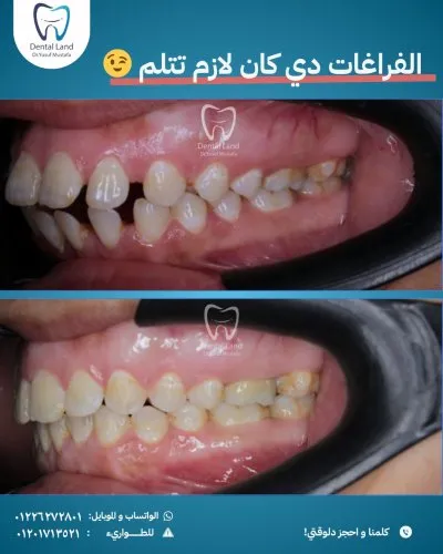 دكتور يوسف مصطفى دنتال لاند لتقويم وتجميل الأسنان