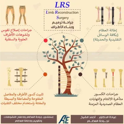 دكتور احمد الشيخ استاذ جراحة العظام