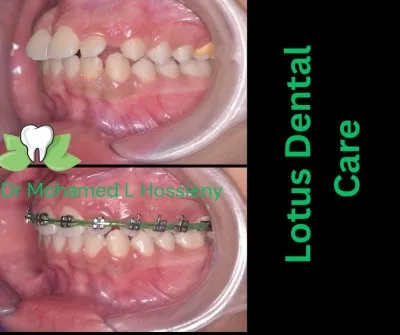 دكتور محمد الحسينى شاهين أخصائى طب الأسنان
