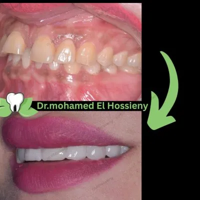 دكتور محمد الحسينى شاهين أخصائى طب الأسنان