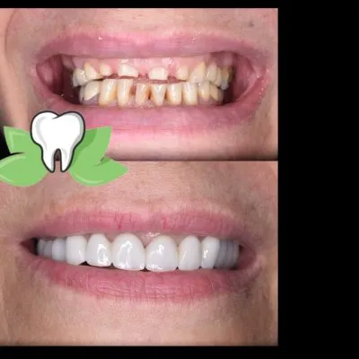 دكتور محمد الحسينى شاهين أخصائى طب الأسنان