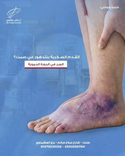 استاذ دكتور تامر خفاجي استشاري جراحة اوعية دموية