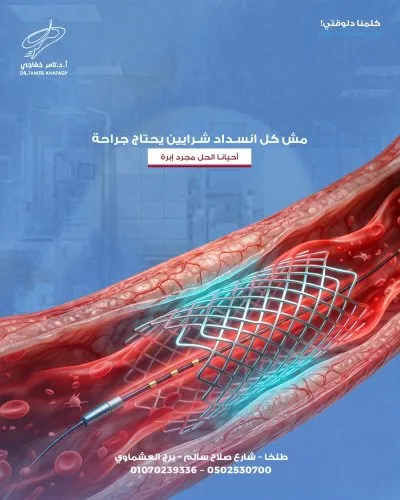 استاذ دكتور تامر خفاجي استشاري جراحة اوعية دموية