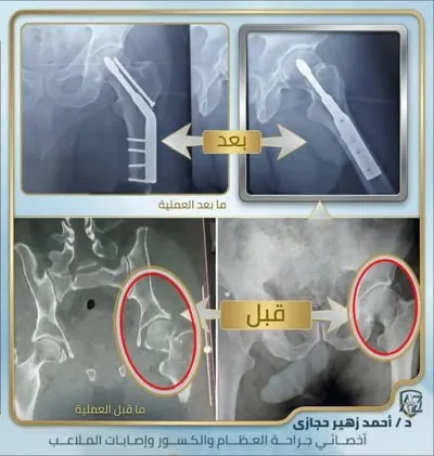 دكتور أحمد زهير حجازي أخصائي جراحة العظام والكسور