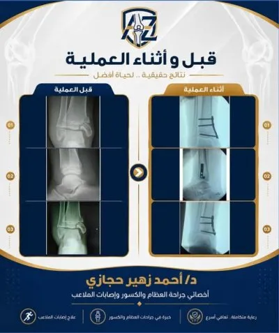دكتور أحمد زهير حجازي أخصائي جراحة العظام والكسور
