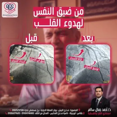 دكتور  احمد جمال سالم استشاري القلب و الاوعية الدموية
