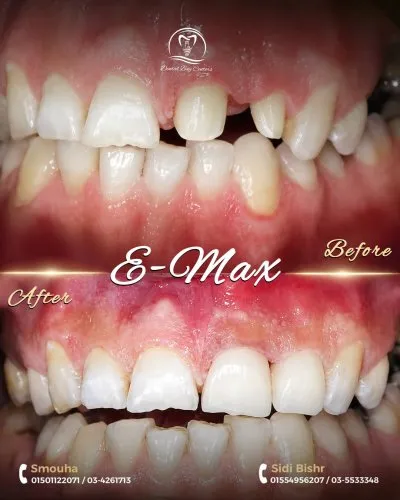 دينتال باى للاسنان Dental Bay Center