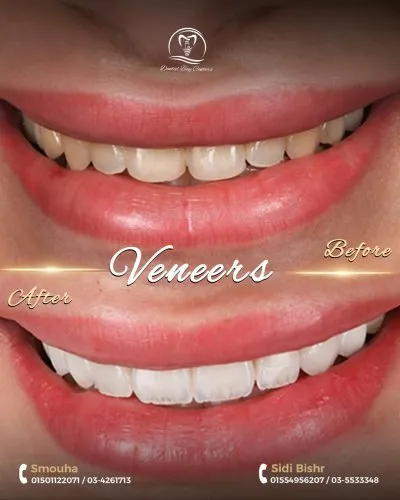 دينتال باى للاسنان Dental Bay Center