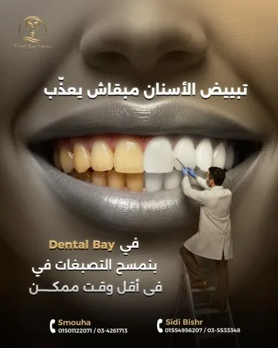 دينتال باى للاسنان Dental Bay Center