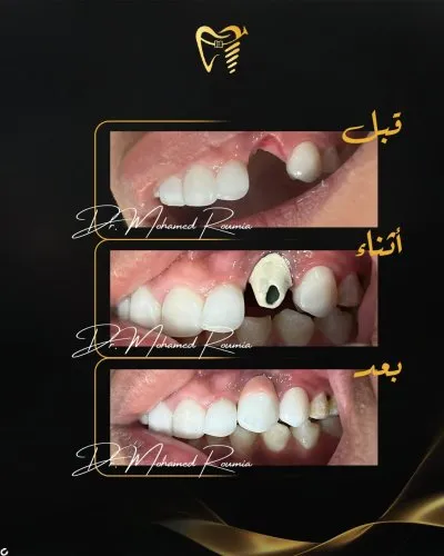 دكتور محمد رومية أخصائي تجميل وزراعة الأسنان