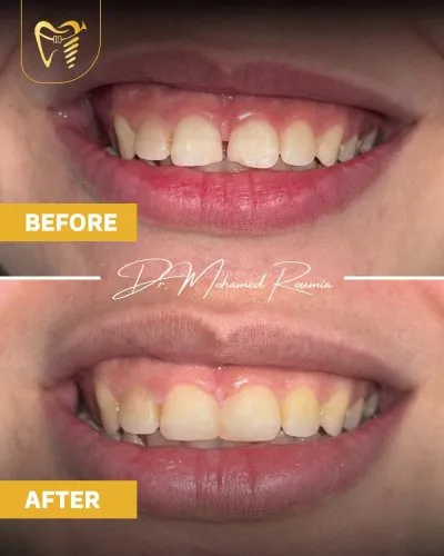 دكتور محمد رومية أخصائي تجميل وزراعة الأسنان