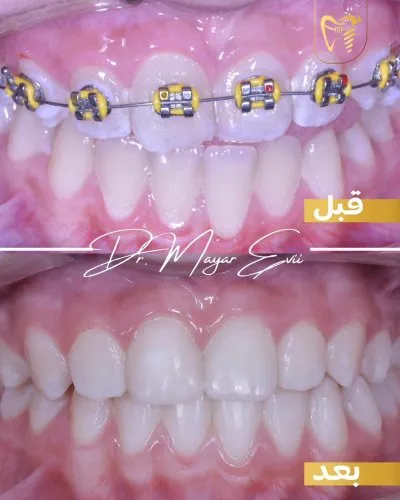 دكتور محمد رومية أخصائي تجميل وزراعة الأسنان
