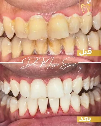 دكتور محمد رومية أخصائي تجميل وزراعة الأسنان