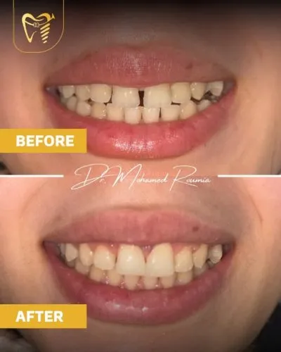 دكتور محمد رومية أخصائي تجميل وزراعة الأسنان