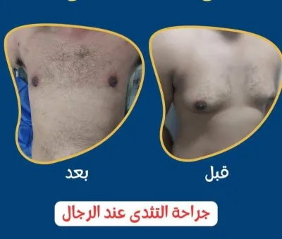 دكتور ممدوح سالم إستشاري جراحة تجميل وتنسيق قوام