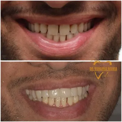 دكتور محمد رومية أخصائي تجميل وزراعة الأسنان