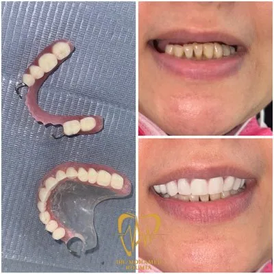 دكتور محمد رومية أخصائي تجميل وزراعة الأسنان