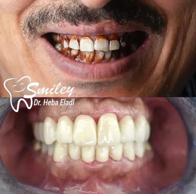 دكتورة هبة العدل مركز سمايلى للاسنان