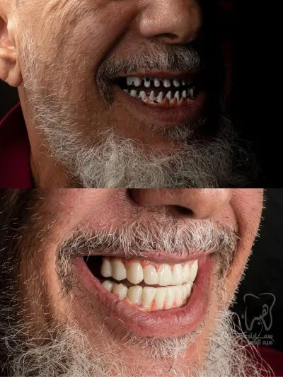 دكتورة هبة العدل مركز سمايلى للاسنان