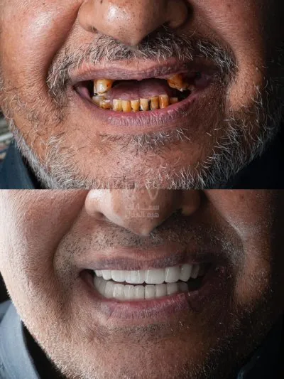 دكتورة هبة العدل مركز سمايلى للاسنان