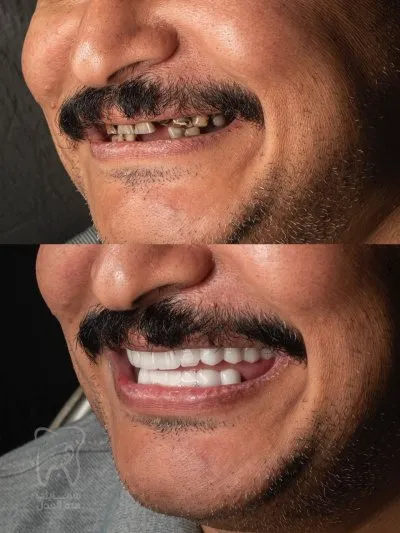 دكتورة هبة العدل مركز سمايلى للاسنان