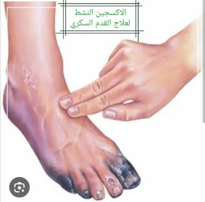 دكتور اشرف صبرى إستشاري علاج بالأكسجين
