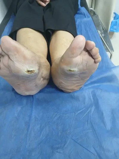 دكتور اشرف صبرى إستشاري علاج بالأكسجين