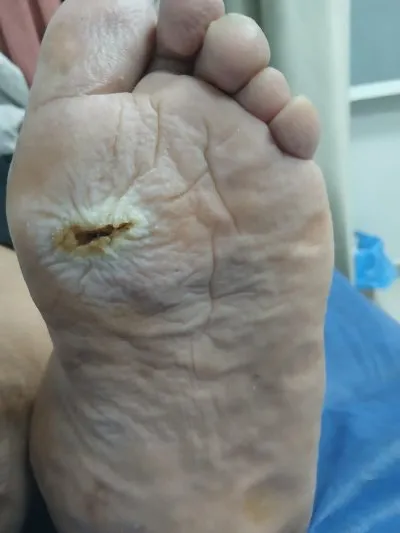 دكتور اشرف صبرى إستشاري علاج بالأكسجين