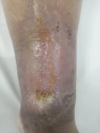 دكتور اشرف صبرى إستشاري علاج بالأكسجين