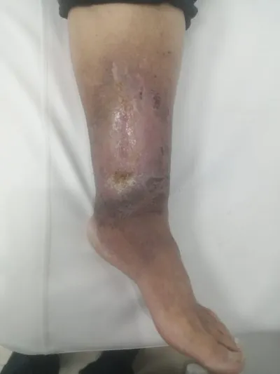 دكتور اشرف صبرى إستشاري علاج بالأكسجين