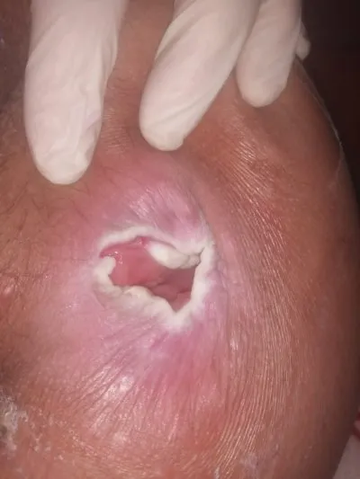 دكتور اشرف صبرى إستشاري علاج بالأكسجين