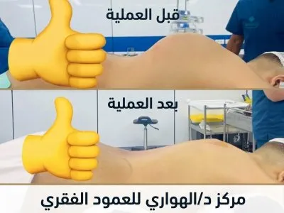 مركز الهواري دكتور طه الهواري استشاري جراحات عظام و عمود فقري