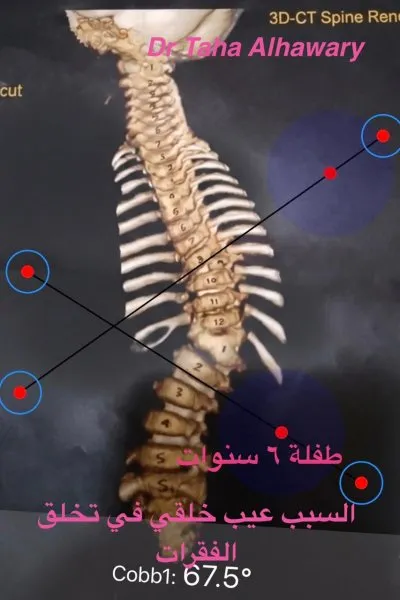 مركز الهواري دكتور طه الهواري استشاري جراحات عظام و عمود فقري