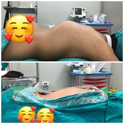 مركز الهواري دكتور طه الهواري استشاري جراحات عظام و عمود فقري