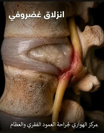 مركز الهواري دكتور طه الهواري استشاري جراحات عظام و عمود فقري