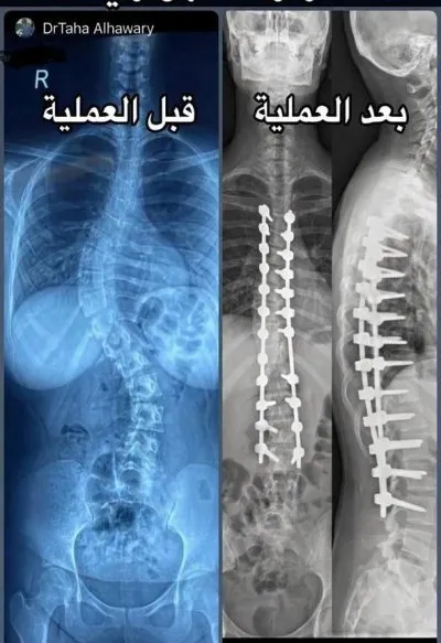 مركز الهواري دكتور طه الهواري استشاري جراحات عظام و عمود فقري