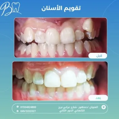 مركز دكتور باسم برهام لطب الفم وتقويم و تجميل الأسنان