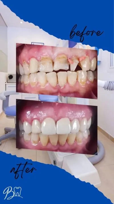 مركز دكتور باسم برهام لطب الفم وتقويم و تجميل الأسنان