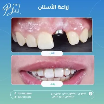 مركز دكتور باسم برهام لطب الفم وتقويم و تجميل الأسنان